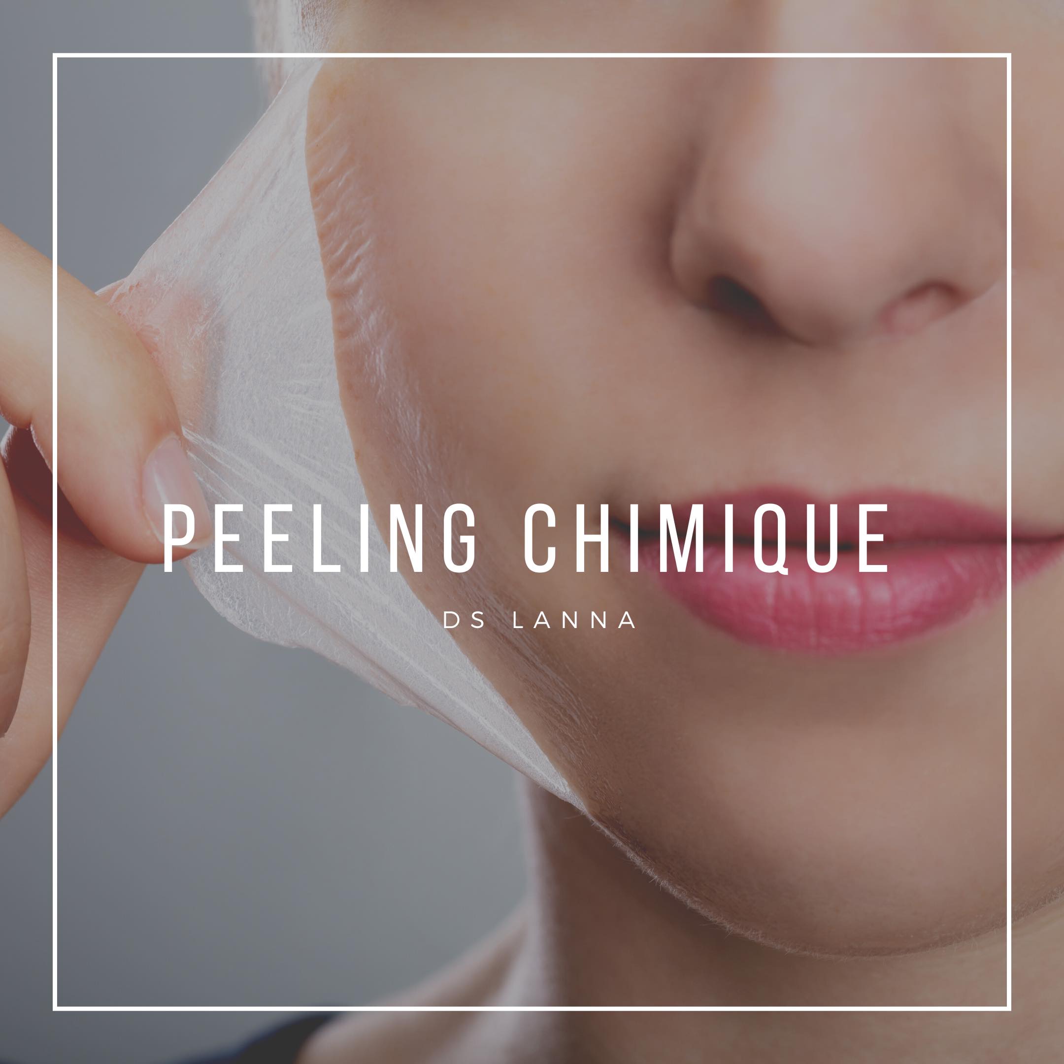 Peeling chimique